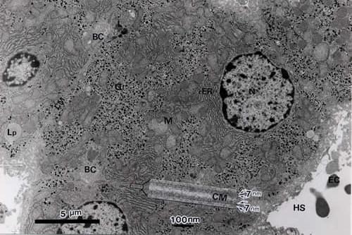 【肝細胞（ブタの肝臓）】 ✕7.000 挿入写真 細胞膜（✕100,000）